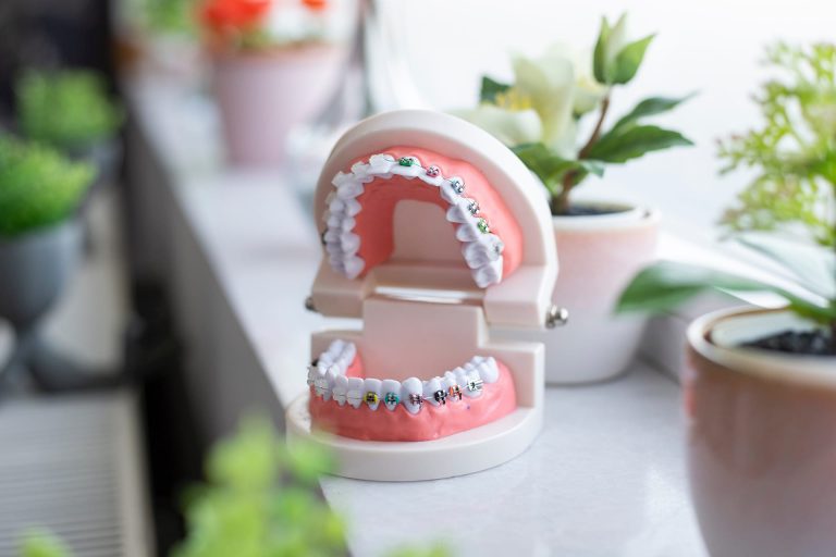 Braces - Orthodontist - Orthodontic Treatment - Dentist - Stukeley Dental